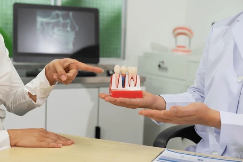 how many dental implants are needed for a full set of teeth