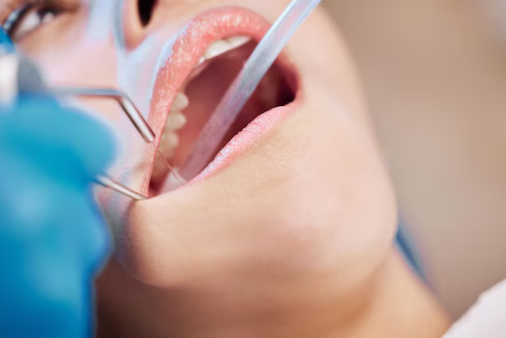 Why Tooth Extractions Are Sometimes Necessary And How It's Done