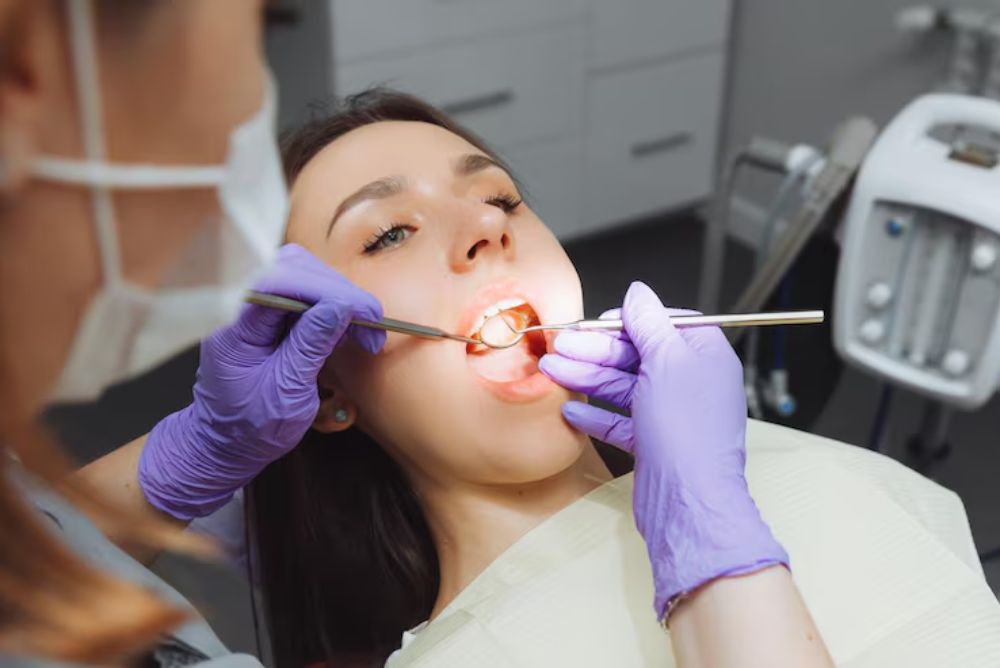 Impacted Tooth Here’s How Expose and Bonding Can Help